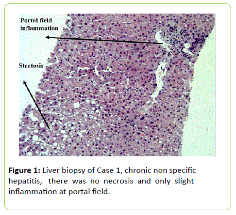 medical-clinical-reviews-Liver-biopsy